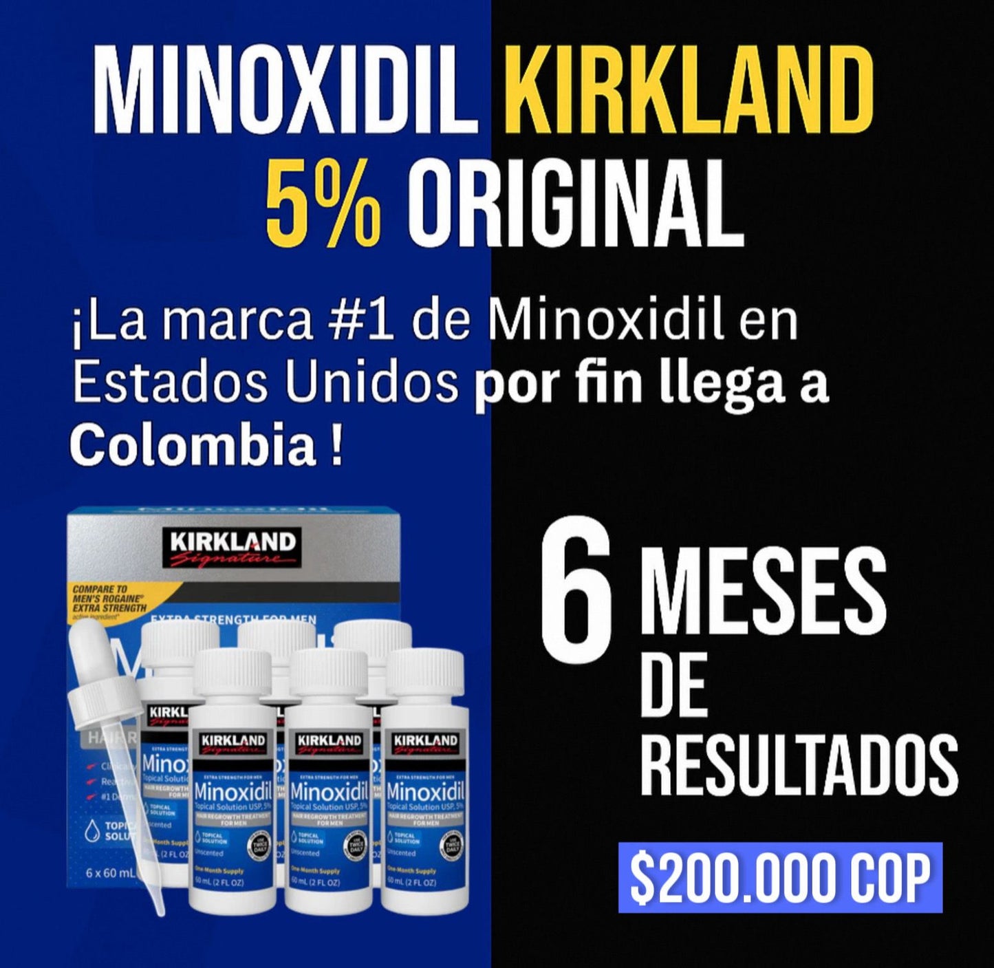 Kirkland Minoxidil 5% Original - 6Frascos (6meses de tratamiento)
